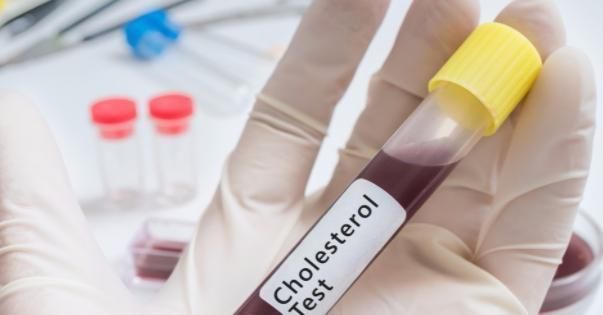 一夜之间|绝经的妇女，前后将有七个“生死障碍”，如果有三个就要保护自己