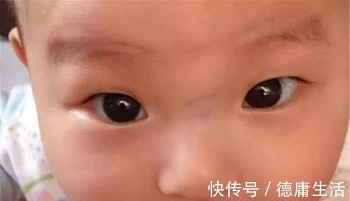 宝宝|“青筋过鼻梁,无事哭三场”这样的孩子脾气差、脾胃虚?别轻信