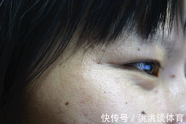 补充|女性体内黄体酮快要“干涸”时,会有怎样表现?该怎么有效补充?