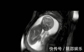 羊水|胎宝在妈妈肚子里无聊不?是时候告诉孕妈真相了,怪可爱的