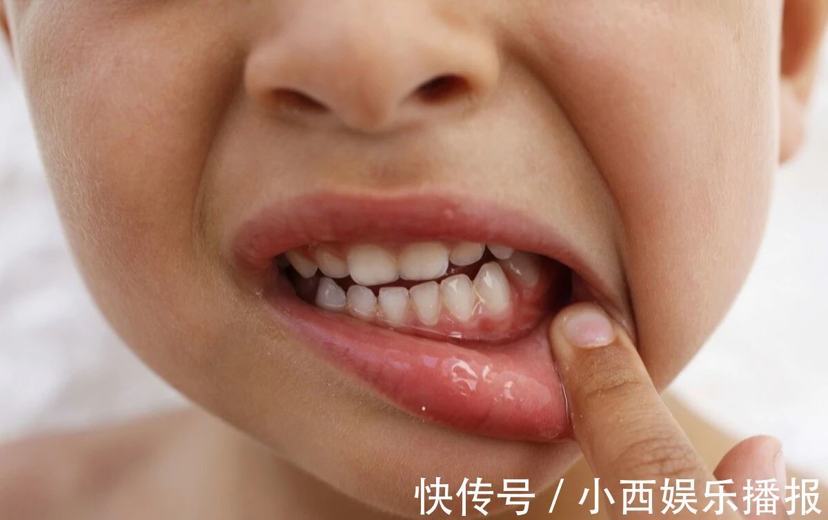 孩子|这5种孩子小时候好看也没用，只会越长越丑，你家孩子有中招吗？