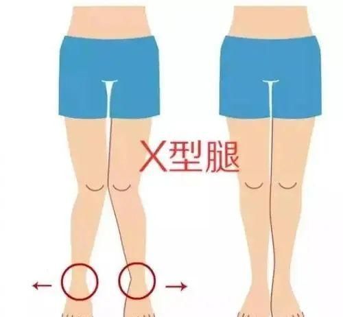 滑膜|建议中老年人：每周吃一次它，强筋骨、养关节、驱寒止痛！