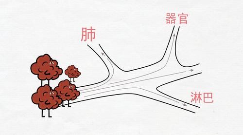 肺癌是如何转移的？