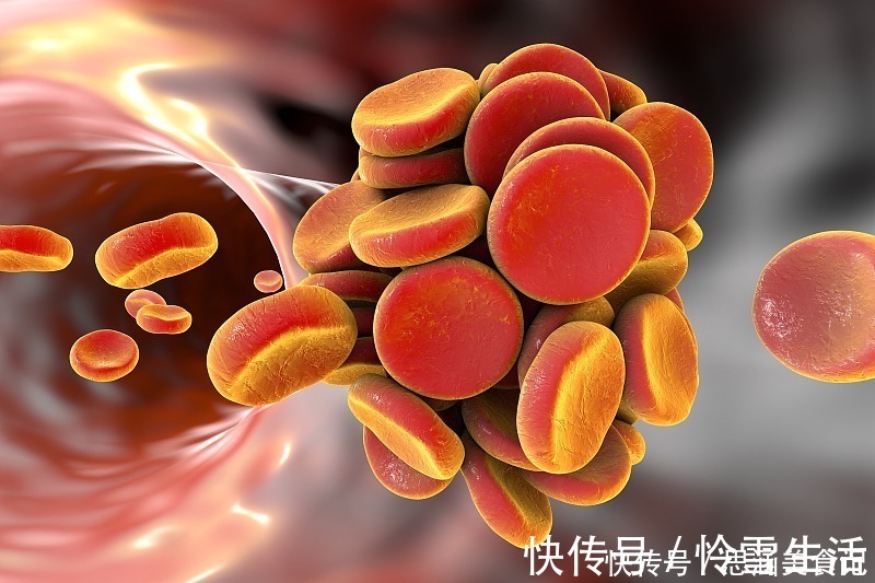 清洁工|血栓的“清洁工”发现了,不是醋,没事喝一喝,血栓“躲着走”