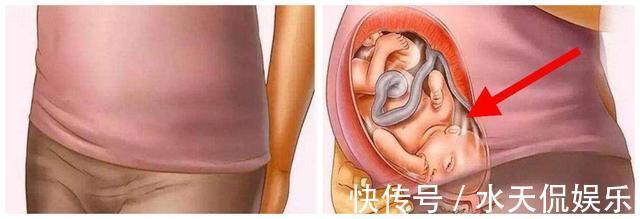 胎盘|生产后一小时内,身体都有哪些变化感慨母爱的伟大