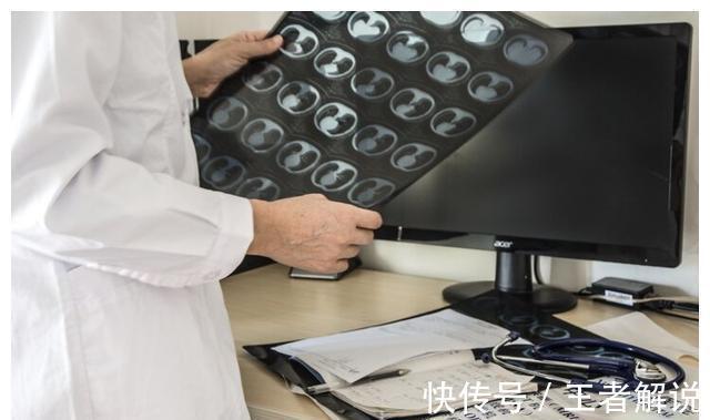 聂卫平|从癌症晚期到肿瘤消失,聂卫平抗癌8年至今未复发,5件事是关键