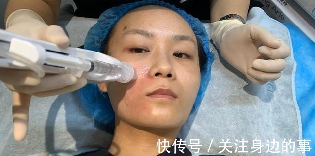 大油皮 大油皮必看!花费10000元总结出来的医美项目推荐!