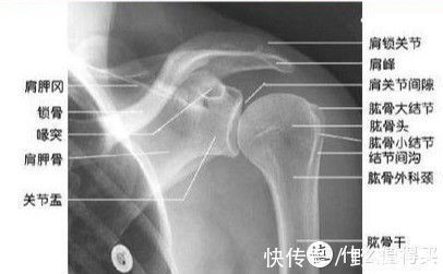 健身|健身时肩膀痛了怎么办？别“病急乱投医”，可以试试这些方法