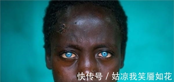 眼睛|男孩从小眼睛是蓝色的,长大后去医院检查的结果,让人惋惜了