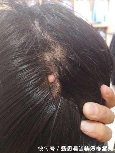 奶奶|4岁孙子睡觉总捂着头,奶奶半夜扒开头发,忍不住掉下眼泪