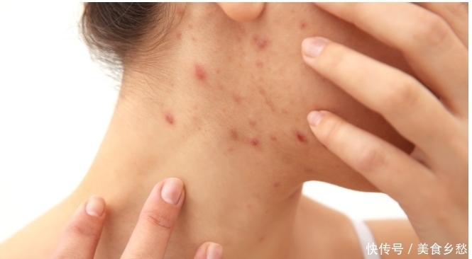 女人想要拥有“干净脸”,建议睡前做这3件事,皮肤细腻又光滑