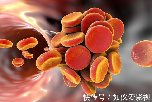 内膜|脑出血越来越多,哈佛大学医学院:坚持做到这6件事,远离高血压