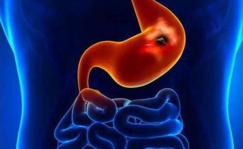 胃黏膜|早晨是养胃“黄金期”，养胃护胃，建议多吃3种养胃早餐