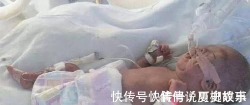 血型|这种血型的妈妈建议只生一个,否则二胎可能引起“新生儿溶血症”