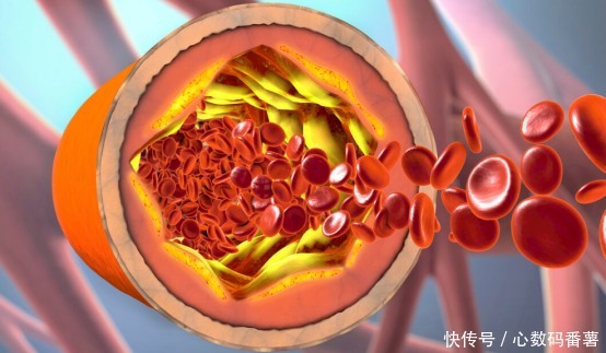 65岁老人血脂降低,内科医生:“1物”可劲吃,给血管“洗个澡”