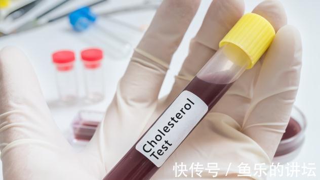 冠状动脉|心血管专家：这“3点”是冠心病的真凶！只要少1条，健康加1倍