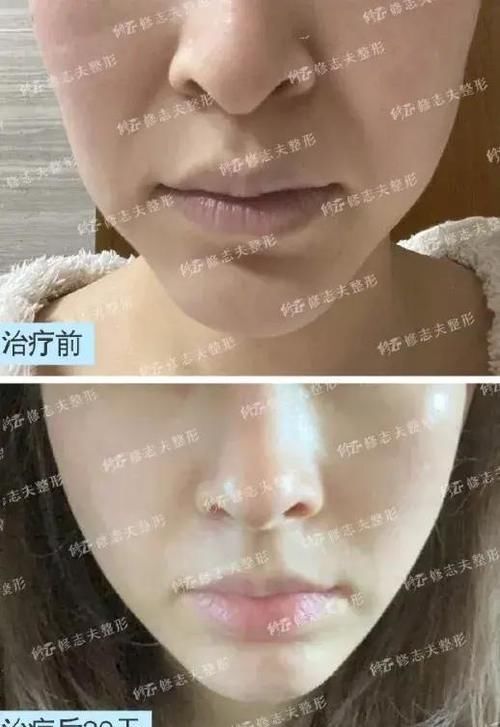 如何防止皮肤衰老、松弛和长皱纹？