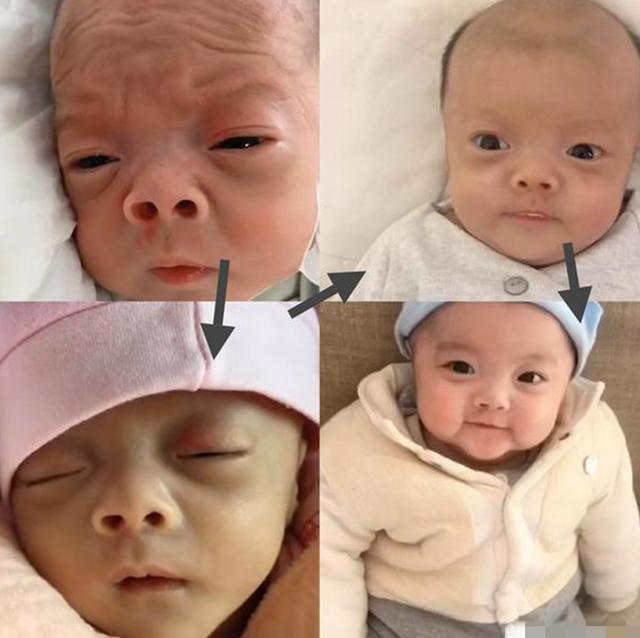 视力|还记得“丑哭宝妈”的网红宝宝吗?当初你嫌我丑,如今美到认不出