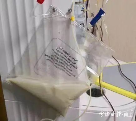 性胰腺炎|可怕！高管跟同事聚餐后竟抽出“牛奶血”