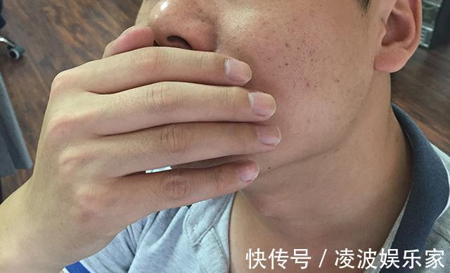 脑梗|脑梗来临,头部先知道!头部出现什么变化,要警惕脑梗