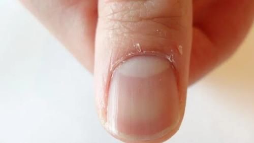 藏在指甲里的健康小秘密，我敢打赌99％的家长都没注意