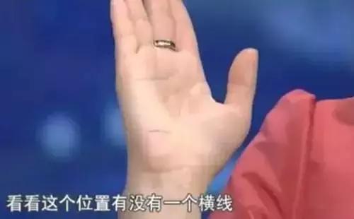 有没有|这条糖尿病线,你手上有没有如果看到它,请注意了