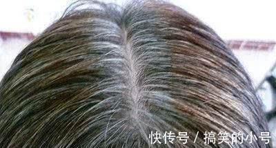 头发|如何做能让白发来得晚一些?除了遗传,有3点我们是可以控制的