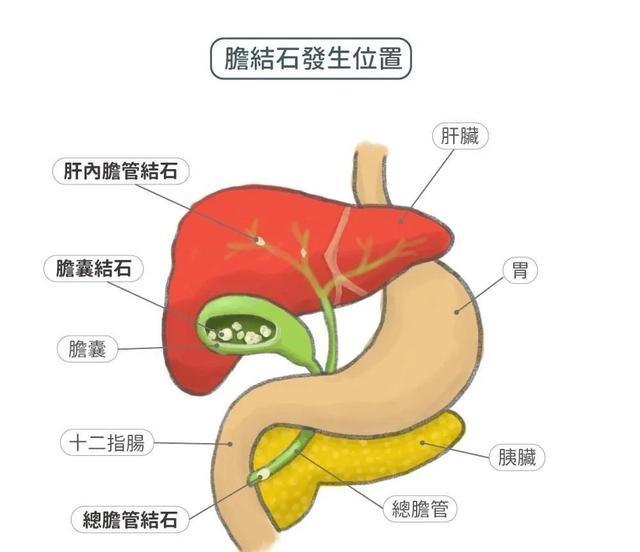 油腻食物|早餐1不要、午餐2不宜、晚餐3不吃！否则五脏慢慢受损