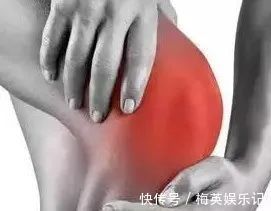 關節|一勺陳醋頂過一個老軍醫，專治膝蓋疼，一用一個好！膝蓋疼快存