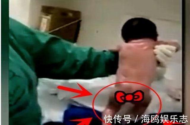 脐带|“最猛新生儿”走红,脐带还没剪就站起来想跑,医生险些没抓住