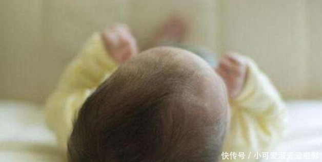 外星人|7个月宝宝头型像外星人,妈妈以为睡姿不正,医生却说必须手术