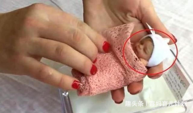 营养物质|14年过去了,那个出生体重仅0.56斤的世界最小婴儿,现如今怎样了