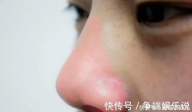 初中女生|初中女生别嫌鼻子不好看,3招变成好看“艺术鼻”,校花嫉妒使我丑陋