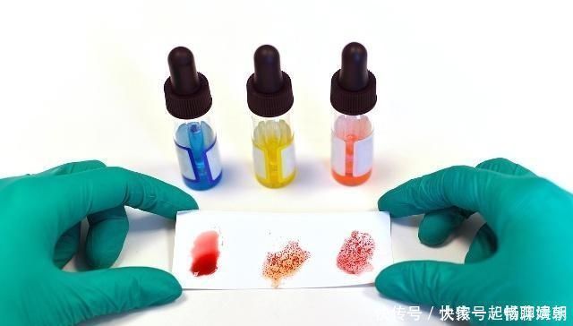 母儿|母儿血型不合的内容,你到底了解多少希望你不要错过这篇文章