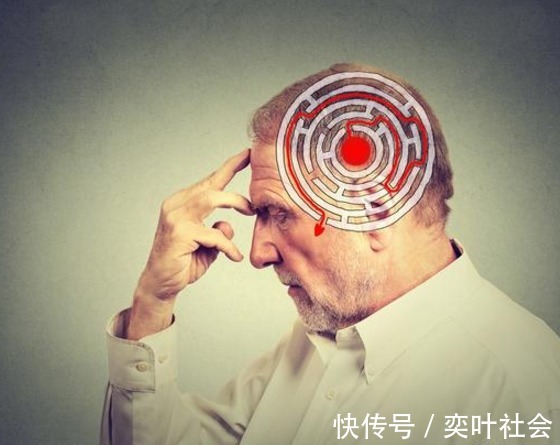 胆固醇|血管''堵''的人,少碰2黄,多做4事,坚持1月,胜吃溶栓药