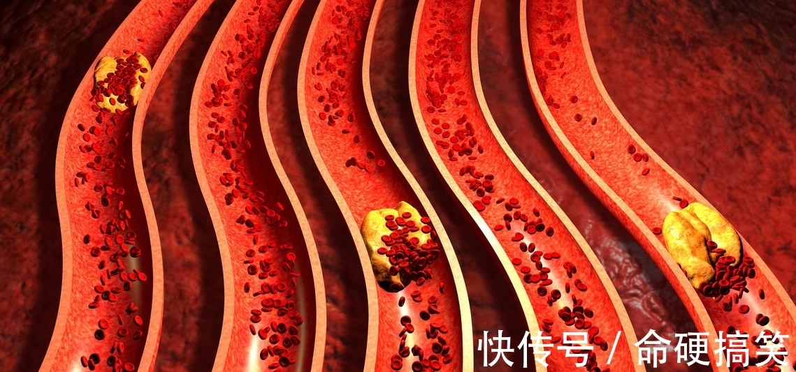 猪油|一种粗粮吃一口等于吃10斤猪油，不及时撤下桌，小心脑梗找上你