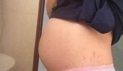 畸形|怀孕后多久胎儿容易发生畸形?其实过了这个危险期就能松口气了