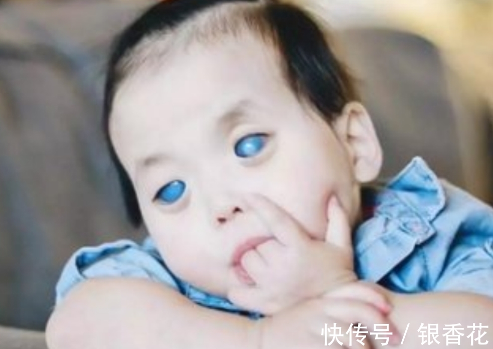 美国|女孩天生“蓝眼睛”被抛弃,美国夫妻远渡重洋领养,改变她的人生