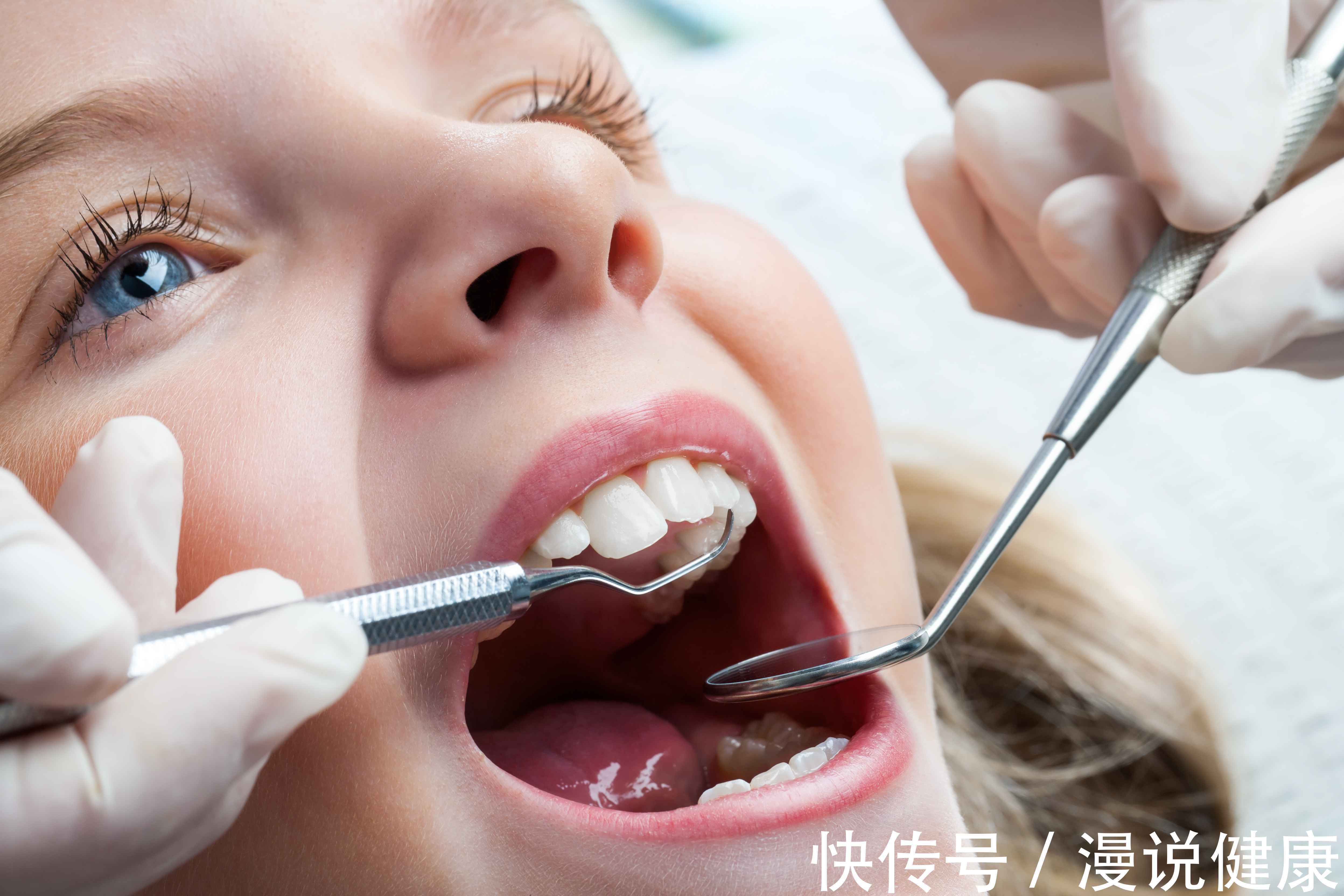 恒牙|动辄上万元!一口好牙,等同于一辆奔驰?种个牙,为何就那么贵?