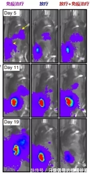 肝转移|让肺癌治疗失效的元凶竟然是它!逆转方法如此简单—抗癌管家