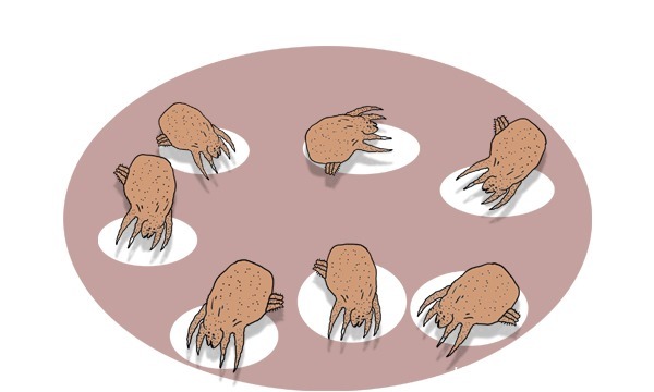 “剪发虫”是什么？如果头上长了剪发虫，该怎么清除呢？