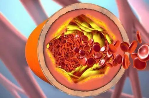 心血管疾病|寿命短的人，通常有“2粗3硬”，一个没有，说明身体比较强健