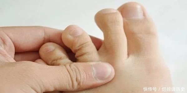 皮肤瘙痒|脚部出现哪些异常表现,说明糖尿病已到?血糖高的危害有哪些?