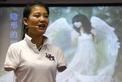 《非誠(chéng)勿擾》無(wú)臂女孩與小伙牽手成功后,下臺(tái)被甩的她現(xiàn)在如何