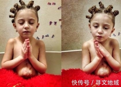 医生|女童心脏长在胸腔外,医生断言活不久,如今已6岁长得特别漂亮