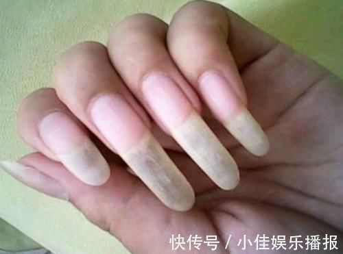 长头发|人闲下来是不是容易长指甲,心宽的人是不是容易长头发?