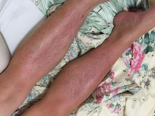 中年|如果肝不好,睡觉时会有5个现象,说明肝病正在慢慢转好