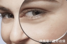 胜过|预防鱼尾纹的4个小妙招,胜过美容术