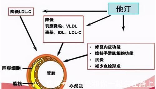 颈动脉|颈动脉有斑块，会有哪些症状？应该如何治疗？医生告诉你答案