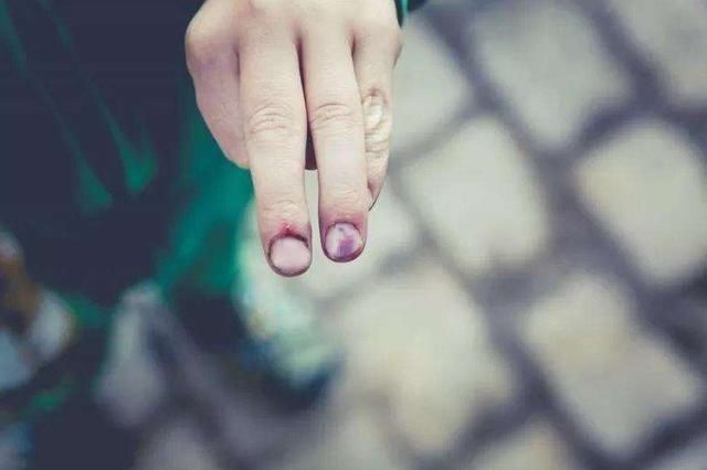 令人|还在说咬指甲是缺营养?医生的一番话令人唏嘘,很多父母没想到